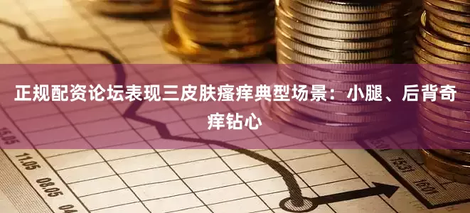 正规配资论坛表现三皮肤瘙痒典型场景：小腿、后背奇痒钻心